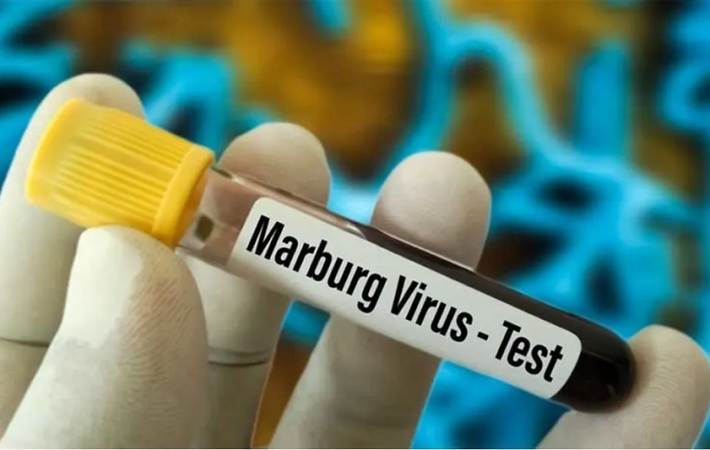 ما هو فيروس ماربورغ؟ .. الحجر الصحي المصري يدخل في حالة التأهب القصوى