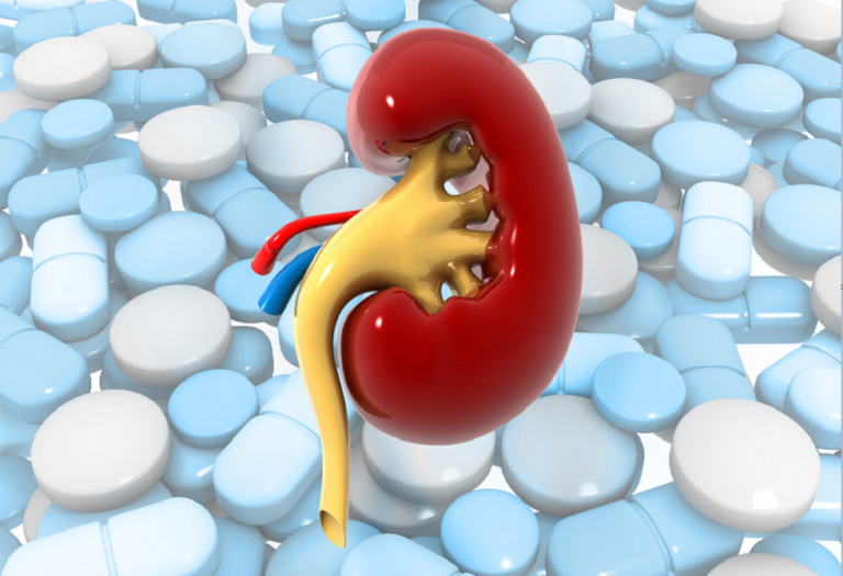 تحذير هام بشأن أدوية تسكين الألم الشائعة وتأثيرها على صحة الكلى