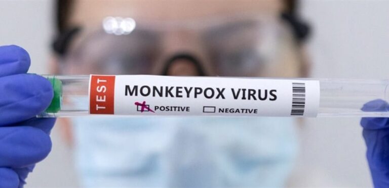 إصابة حالة جديدة بجدري القرود في نيويورك والسلالة الأكثر خطرًا تثير القلق مع ظهور أعراض جديدة