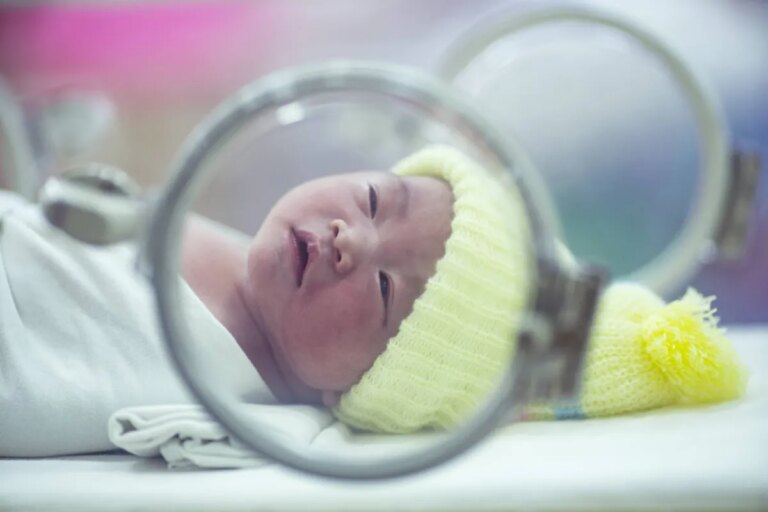 قطرة الكورتيزون تحمي بصر الأطفال المبتسرين وتمنحهم الأمل