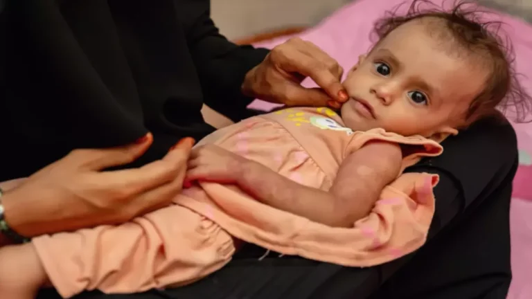 منظمة الصحة العالمية تحذر: اليمن يمر بأزمة إنسانية غير مسبوقة